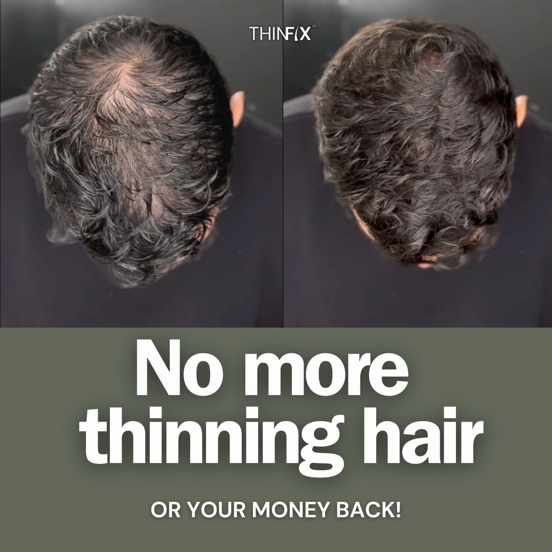 THINFIX™ Hair Growth Routine by OBRO
